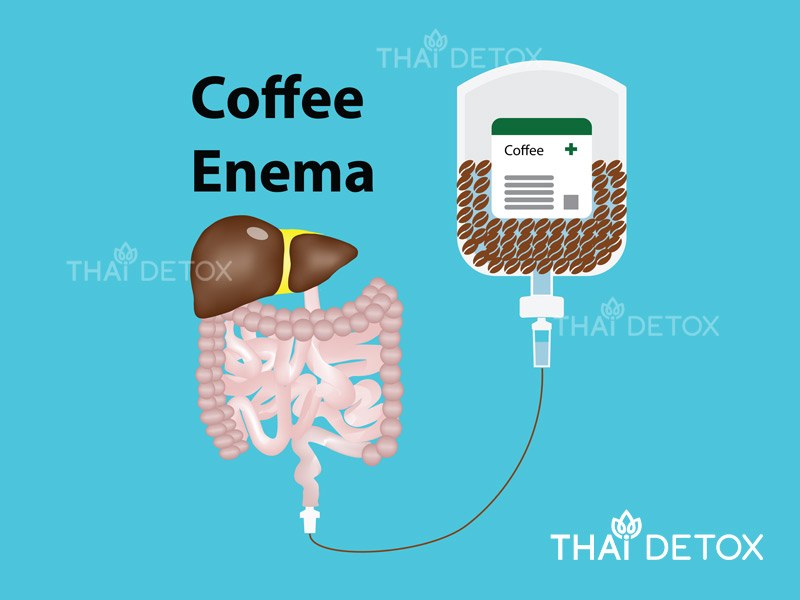 Điều trị ung thư với phương pháp thụt rửa đại tràng bằng cà phê